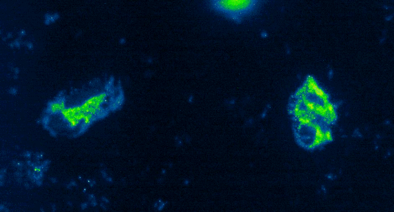 The image shows 2 neutrophils that are firmly adhered and spreading over platelet monolayers while under shear stress. The neutrophil (and platelet) granules are labeled with mepacrine (green). The remainder of the image is pseudocolored.