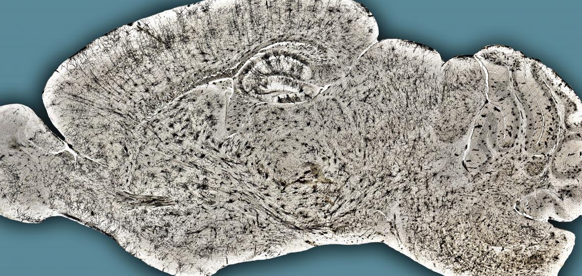 Golgi staining of a mouse brain