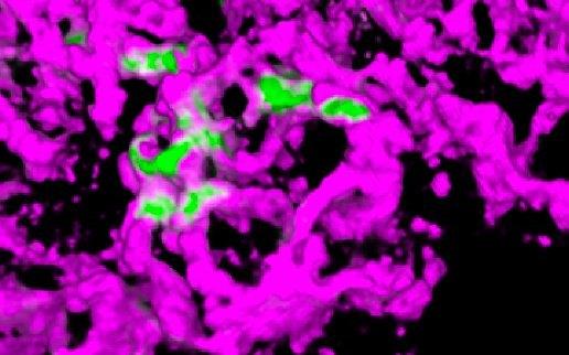 Tumor cells (green) interacting with the lung vasculature (magenta) during metastatic seeding in the lung