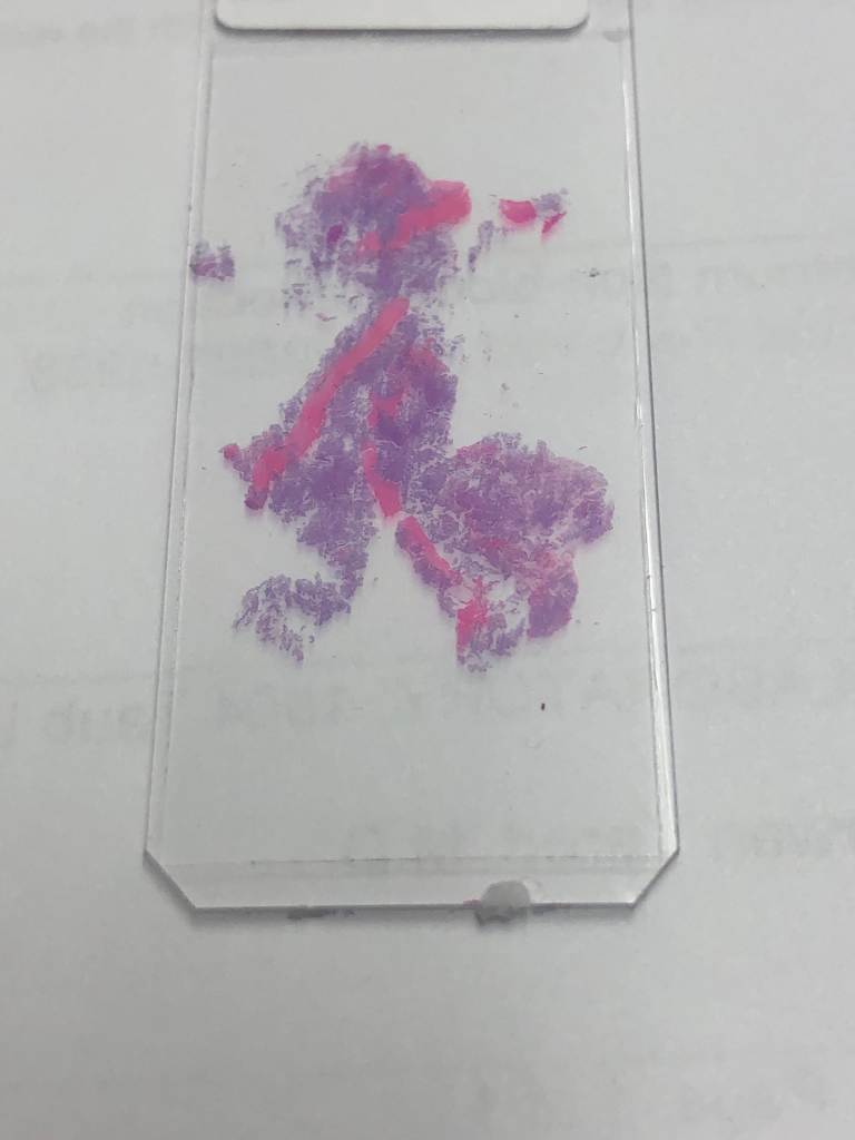 “A happy man enjoying his walk”, Glass slide with H&E stained endometrium