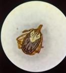 Amblyomma maculatum (adult female)