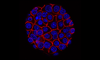 This image shows pancreatic cancer cells (nuclei in blue) growing as a sphere encased in membranes (red). Courtesy of the National Cancer Institute
