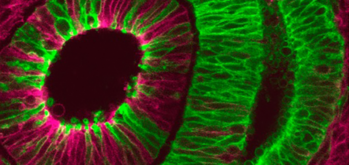 Image of the Month: The developing eye