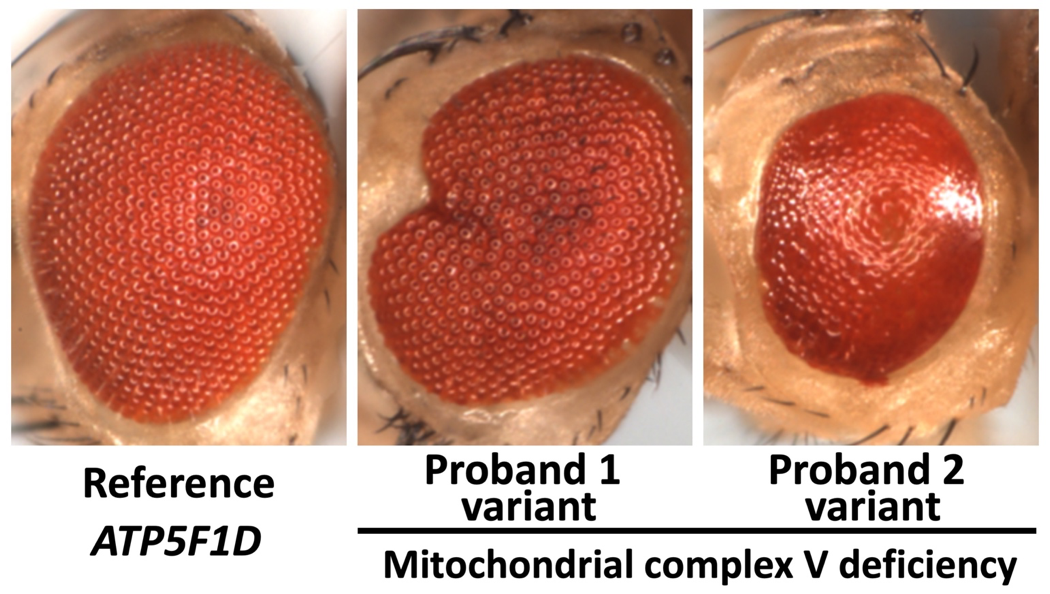 Recessive missense variants in ATP5F1D Recessive missense variants in ATP5F1D