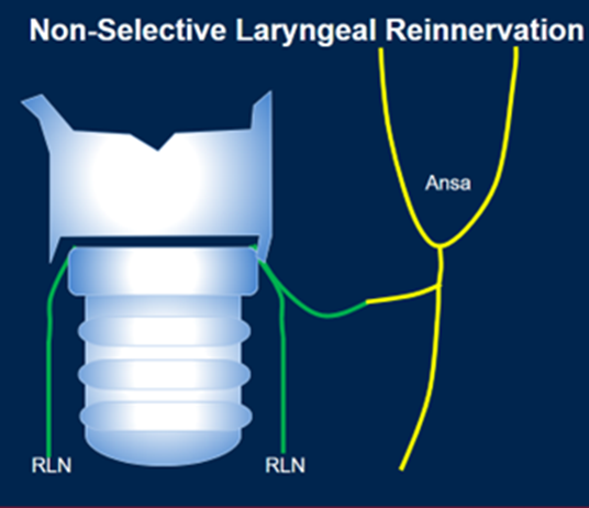 Schematic of laryngeal re-innervation depicts the utilization of the ansa cervicalis to provide neuronal motor input into the recurrent laryngeal never immediately prior to entry into the laryngeal musculature.