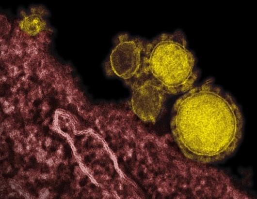Transmission electron micrograph of Middle East Respiratory Syndrome Coronavirus particles, colorized in yellow.