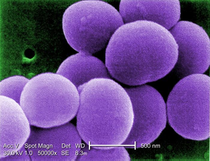 Scanning electron micrograph image showing a strain of Staphylococcus aureus bacteria at high magnification