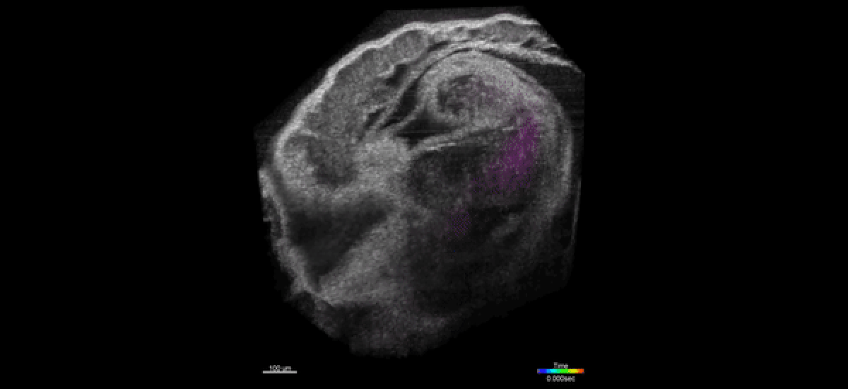 Doppler Image from the Larina Lab