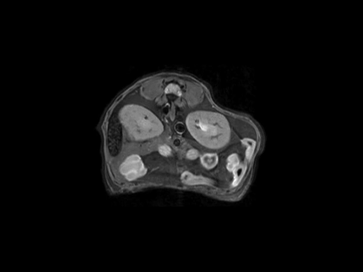 Anatomical MRI of mouse kidneys and spleen