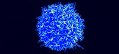 An electron micrograph of a human T cell.