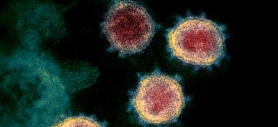 This transmission electron microscope image shows SARS-CoV-2鈥攁lso known as 2019-nCoV, the virus that causes COVID-19鈥攊solated from a patient in the U.S.