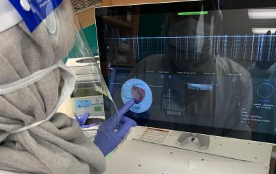 Researchers examine breast tissue removed during a lumpectomy using the OTIS ImgAssist technology.