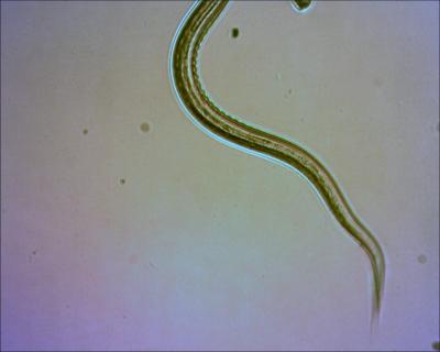 Hookworm