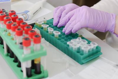 Close up of hands in a laboratory