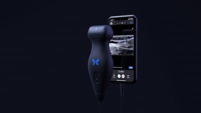 Image of ultrasound device