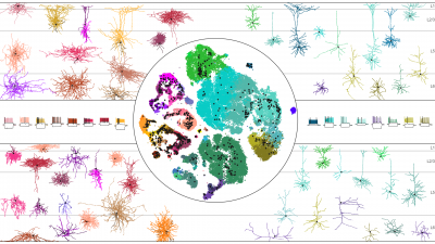 Image showing different sizes of neurons in motor cortex.
