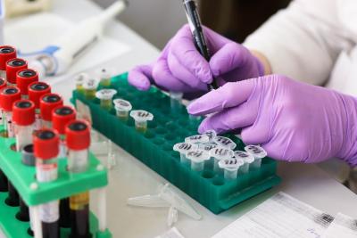 Gloved hands working with test tubes in the lab