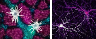 Microscopy Images: (Left) Oak Leaf Surface, (Right) Mouse Brain Neurons