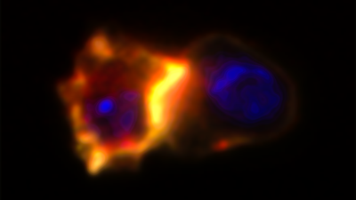 A CAR T cell (left) recruits membrane lipid rafts (yellow/red) to the immune synapse formed with a glioblastoma brain cancer cell (right)