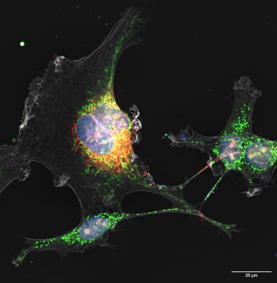 Zika virus's non-structural protein NS1 (red) and mitochondria (green) travel through the tunneling nanotube (TNT, gray) from infected to uninfected placental cells. 