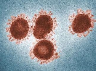 Image of a coronavirus showing the crown-like (corona) appearance.