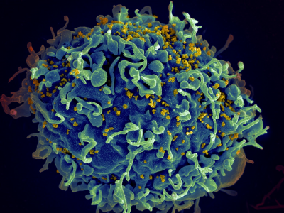 HIV, the AIDS virus (yellow), infecting a human cell
