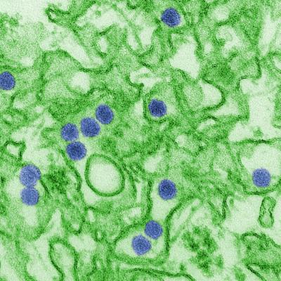 A digitally-colorized transmission electron micrograph (TEM) of Zika virus. Virus particles (colored in blue), are 40 nm in diameter, with an outer envelope, and an inner dense core.