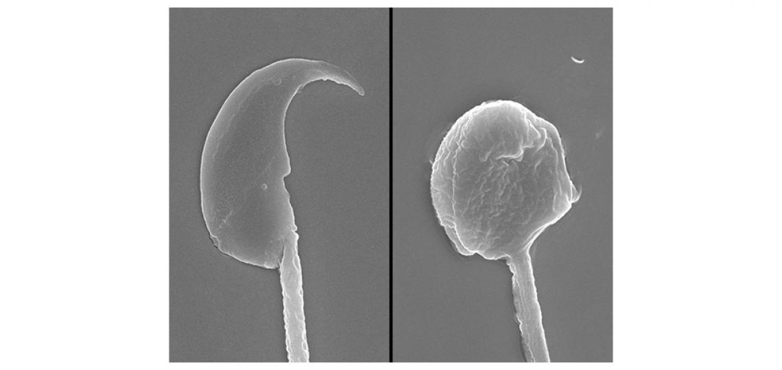 Mouse Sperm Head by Scanning Electron Microscopy
