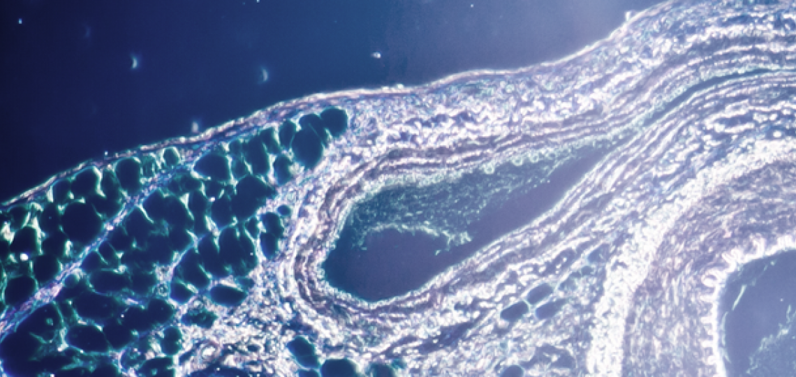 Blood Micrograph
