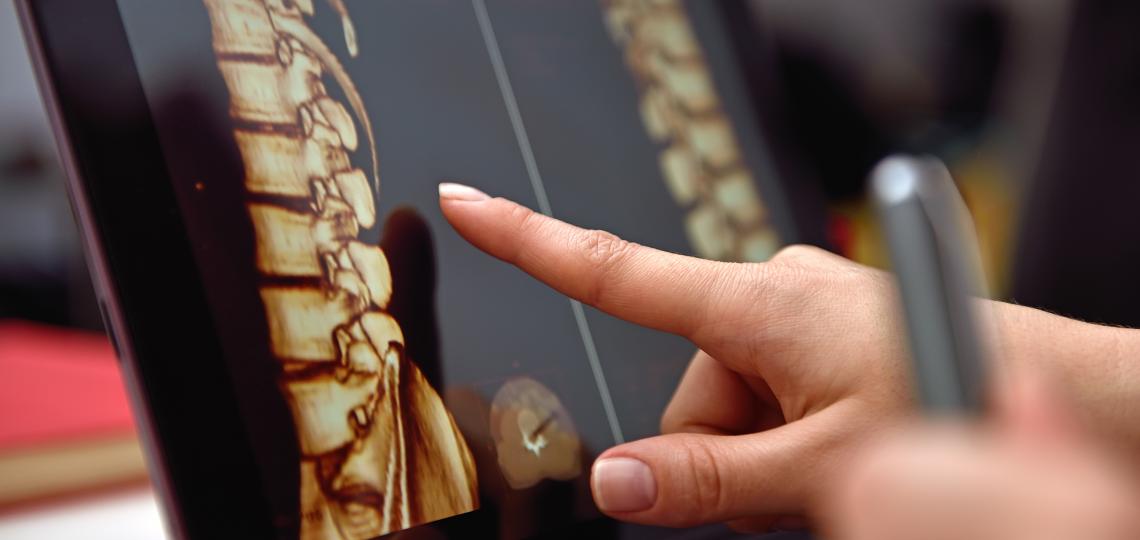 3D spine scan tablet