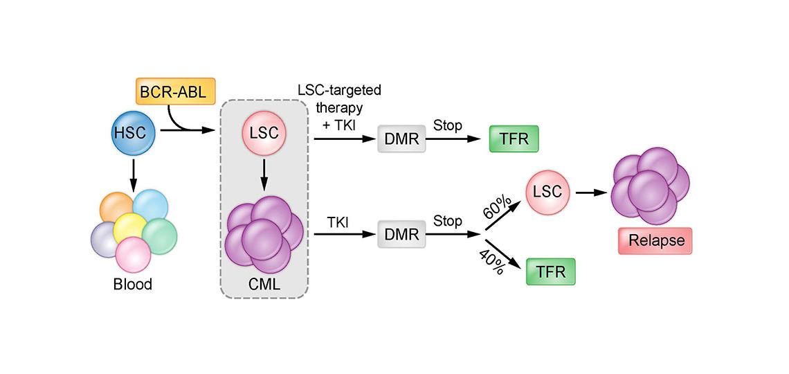 Chronic myeloid leukemia (CML) 