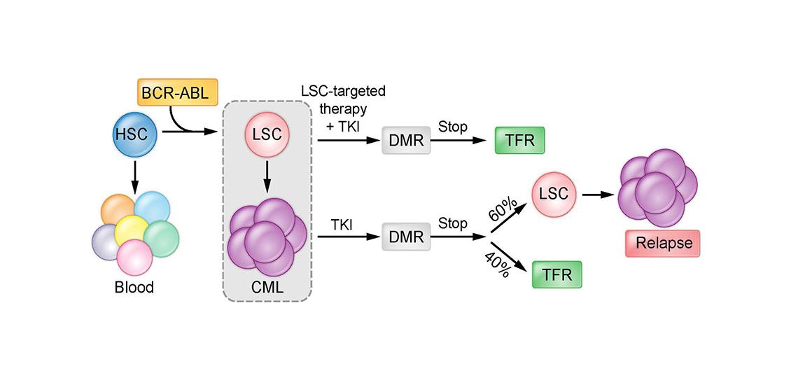 Chronic myeloid leukemia (CML) Chronic myeloid leukemia (CML)