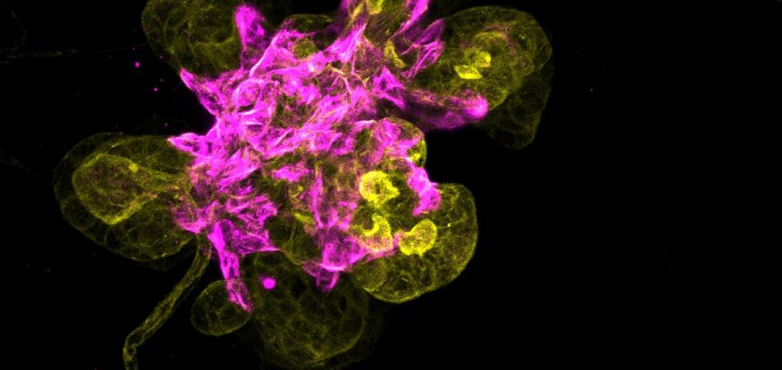 Mammary Organoid Mammary Organoid