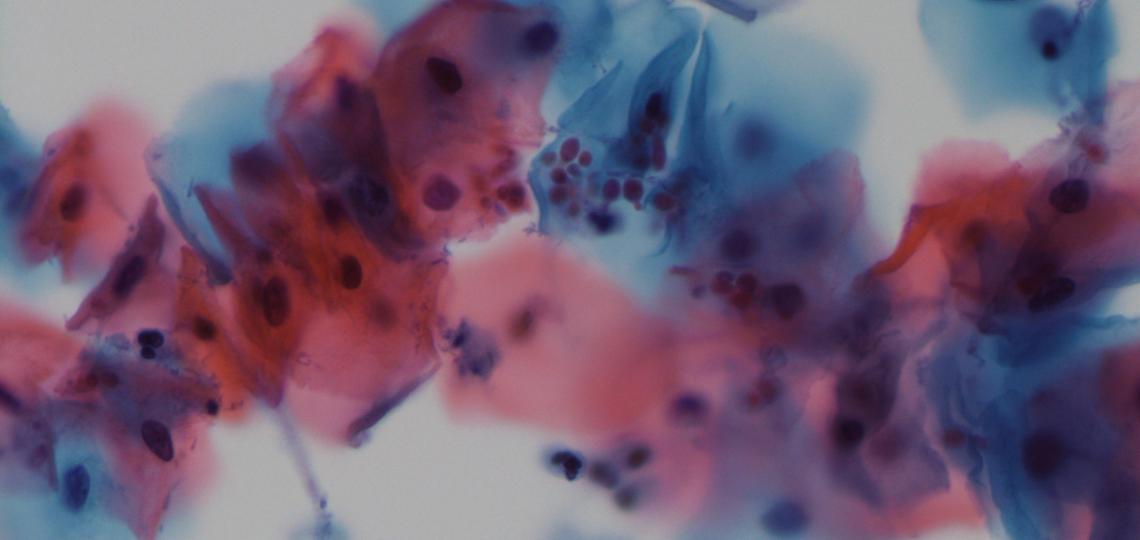 A microscopic image of candida A microscopic image of candida