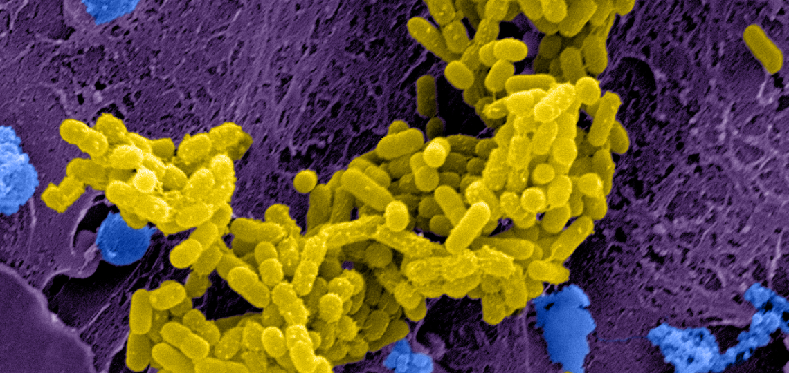 A microscopic image
