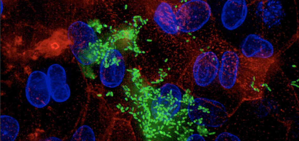 Dr. Maresso Lab image Dr. Maresso Lab image