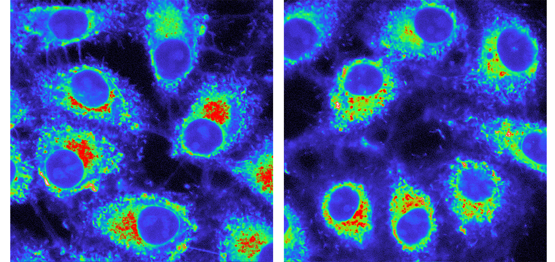 Color scale reflects the lysosomal pH of these HeLa cells captured with fluorescence lifetime imaging