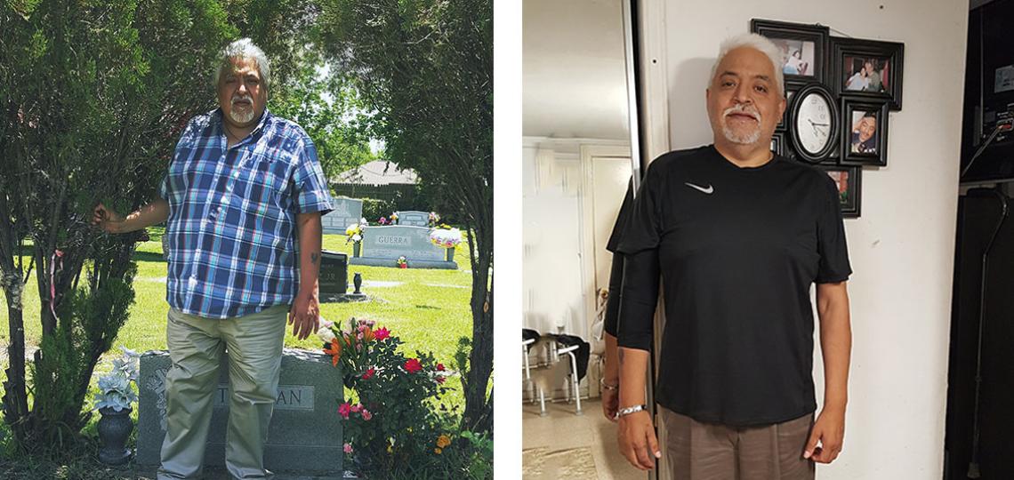 Bariatric patient Ramiro, before and after.