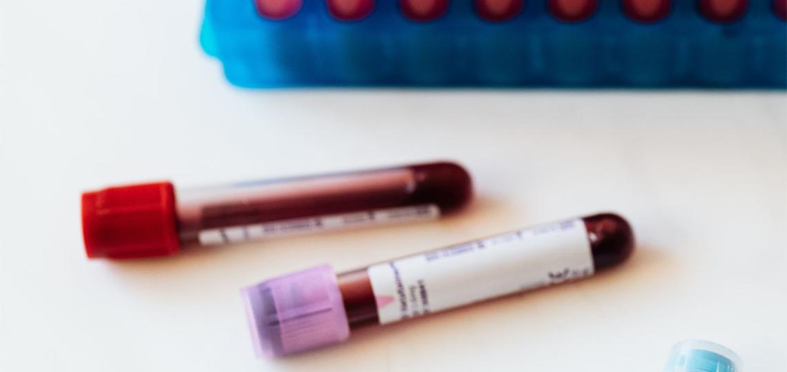 Photo of vials of blood on a table