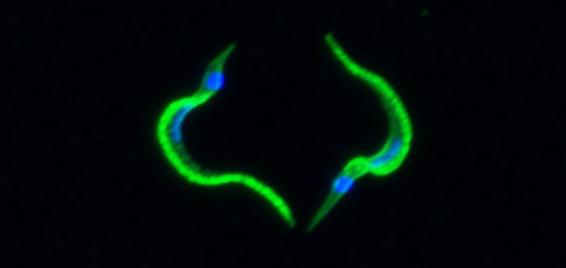 two lime green squiggly lines next to eachother which showcases t.cruzi swimmers