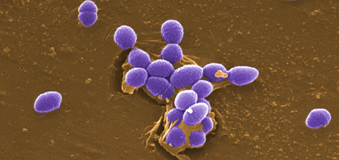 This digitally-colorized scanning electron micrograph (SEM) depicted large numbers of Gram-positive Enterococcus faecalis sp. bacteria.