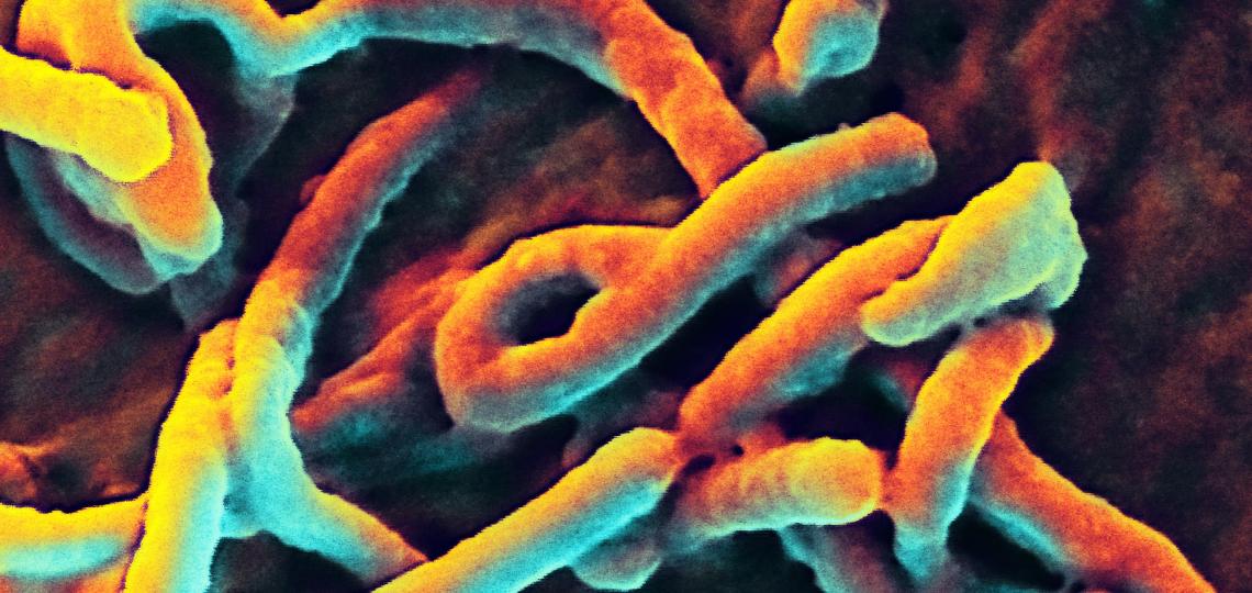 Scanning electron micrograph of Ebola virus budding from the surface of a  monkey cell line