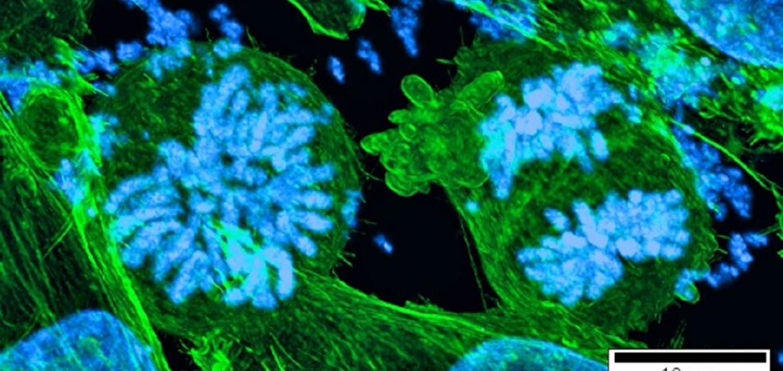 The cells are human pancreatic cancer cells Panc-28, obtained from Cathy Yao, plated on glass, grown in DMEM media (regular media supplemented with 10% Fetal Bovine Serum and antibiotics.) Stained with DAPI and Alex Fluor 488 (phallodian).