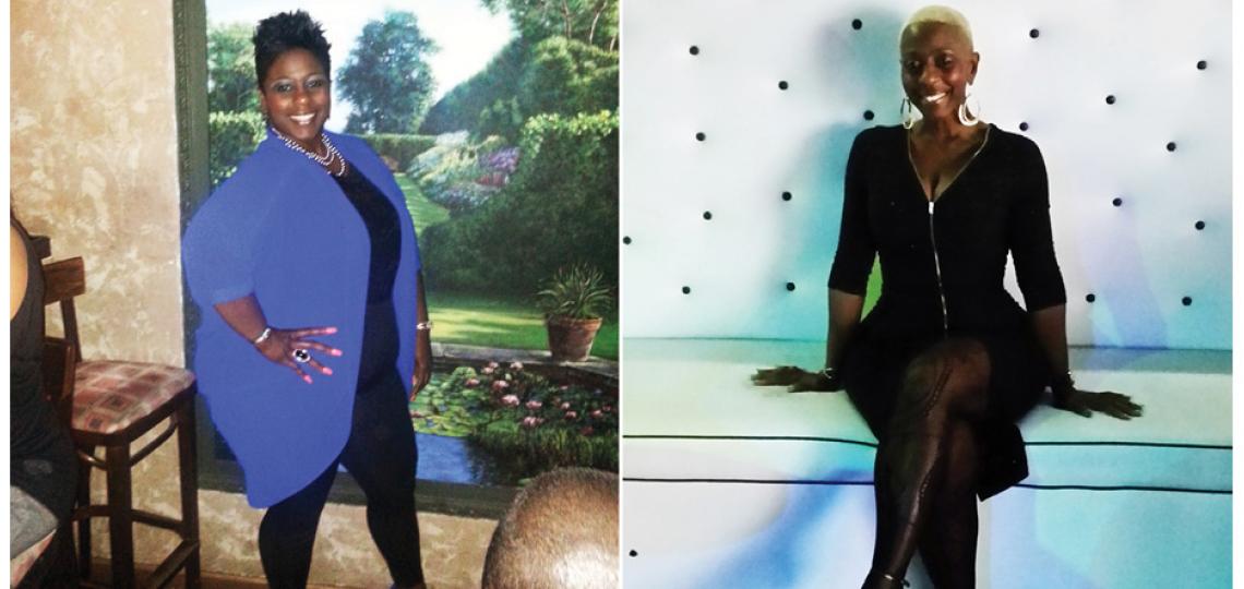 Before and after weight loss surgery Before and after weight loss surgery