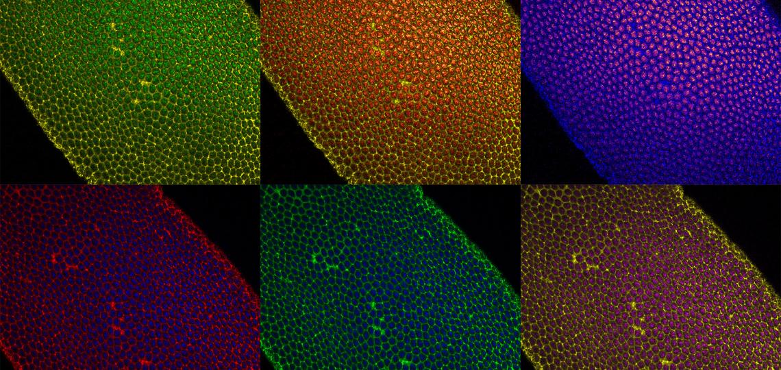 This image shows a surface view of a fixed Drosophila melanogaster embryo undergoing cellularization, its first morphogenetic event in development.