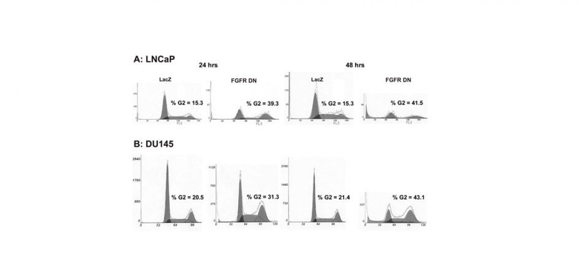 Cell cycle analysis of prostate cancer cells Cell cycle analysis of prostate cancer cells expressing dominant negative FGF receptor.