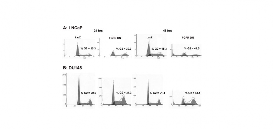 Cell cycle analysis of prostate cancer cells expressing dominant negative FGF receptor.