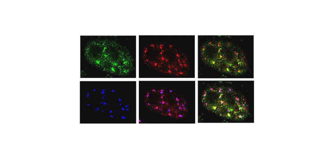 Colocalization of Cdk9 (green), cyclin T1 (red), and SC35 (blue) in HeLa cells.