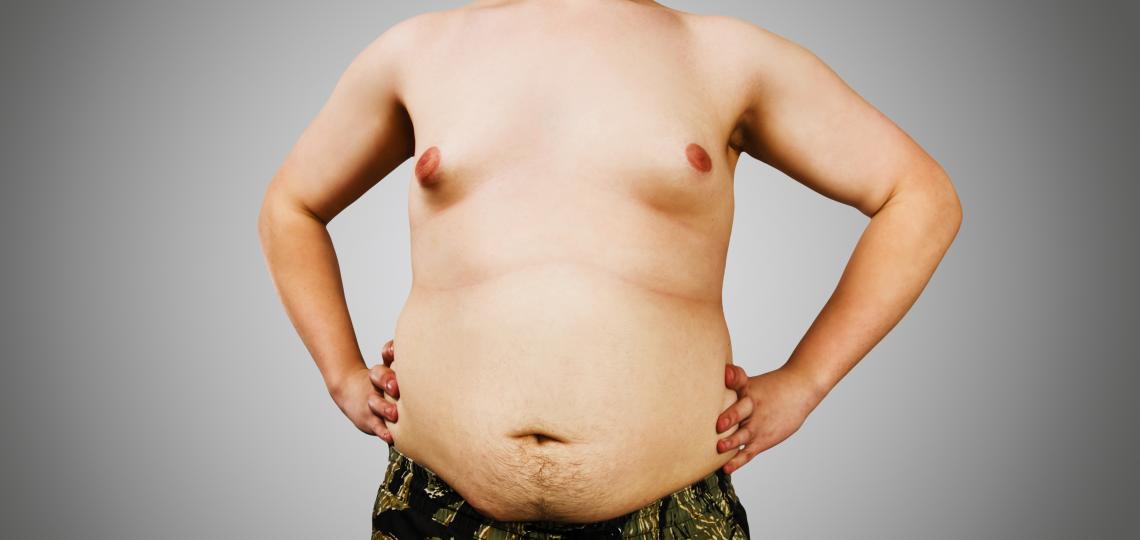 Gynecomastia