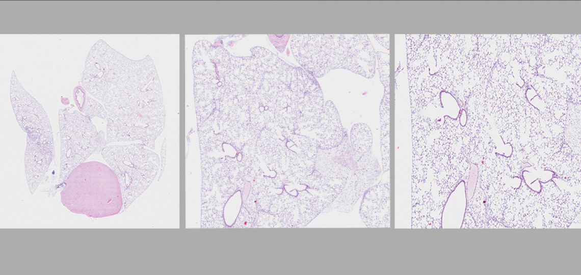 Digital imaging of stained slides
